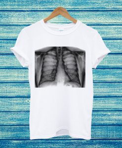 X-Ray Tee FRC251 White T Shirt
