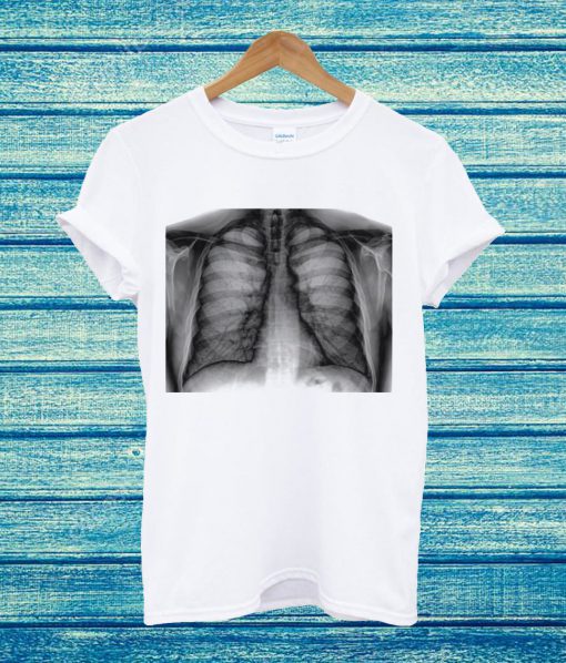X-Ray Tee FRC251 White T Shirt